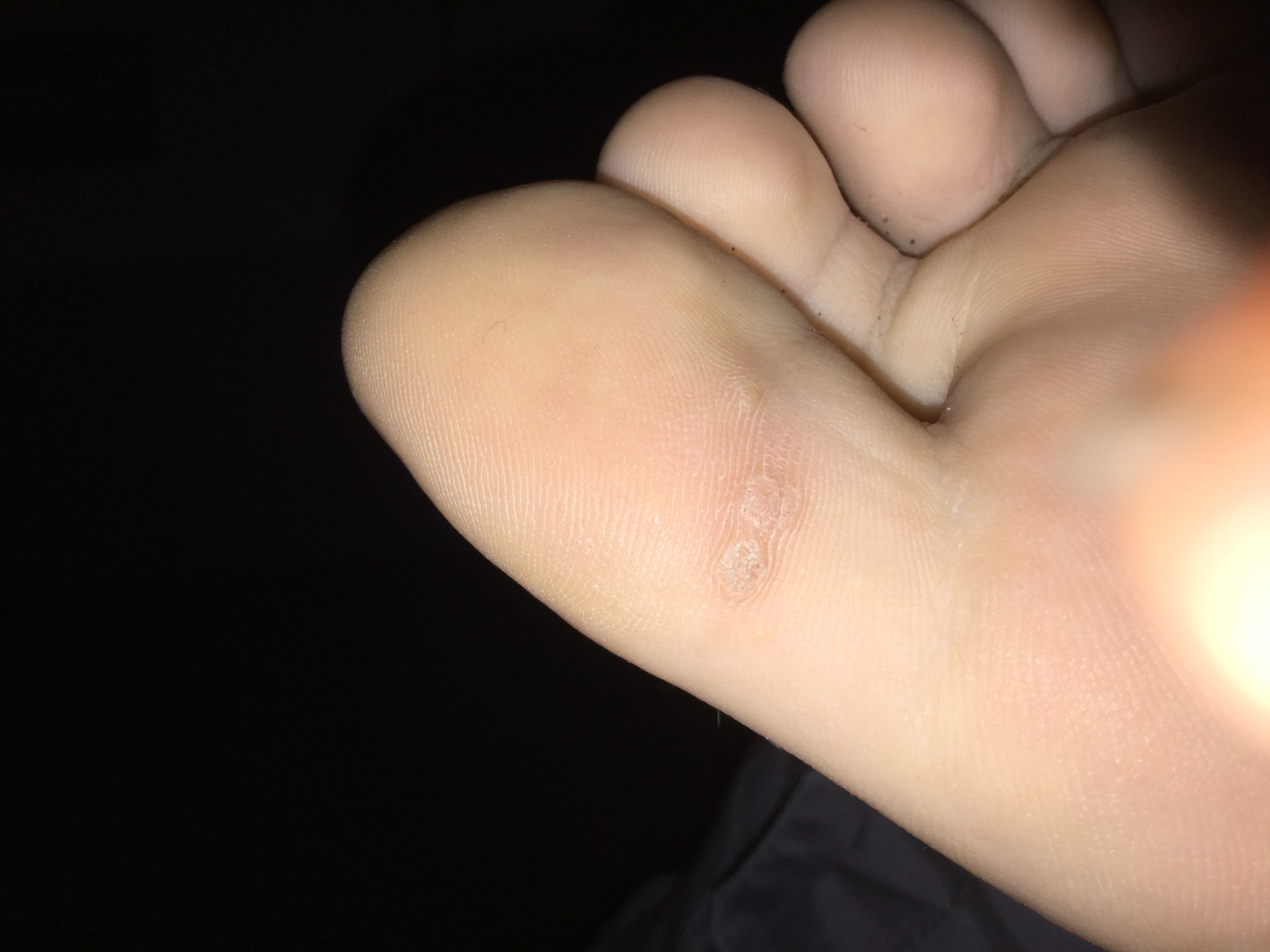 Picture for question