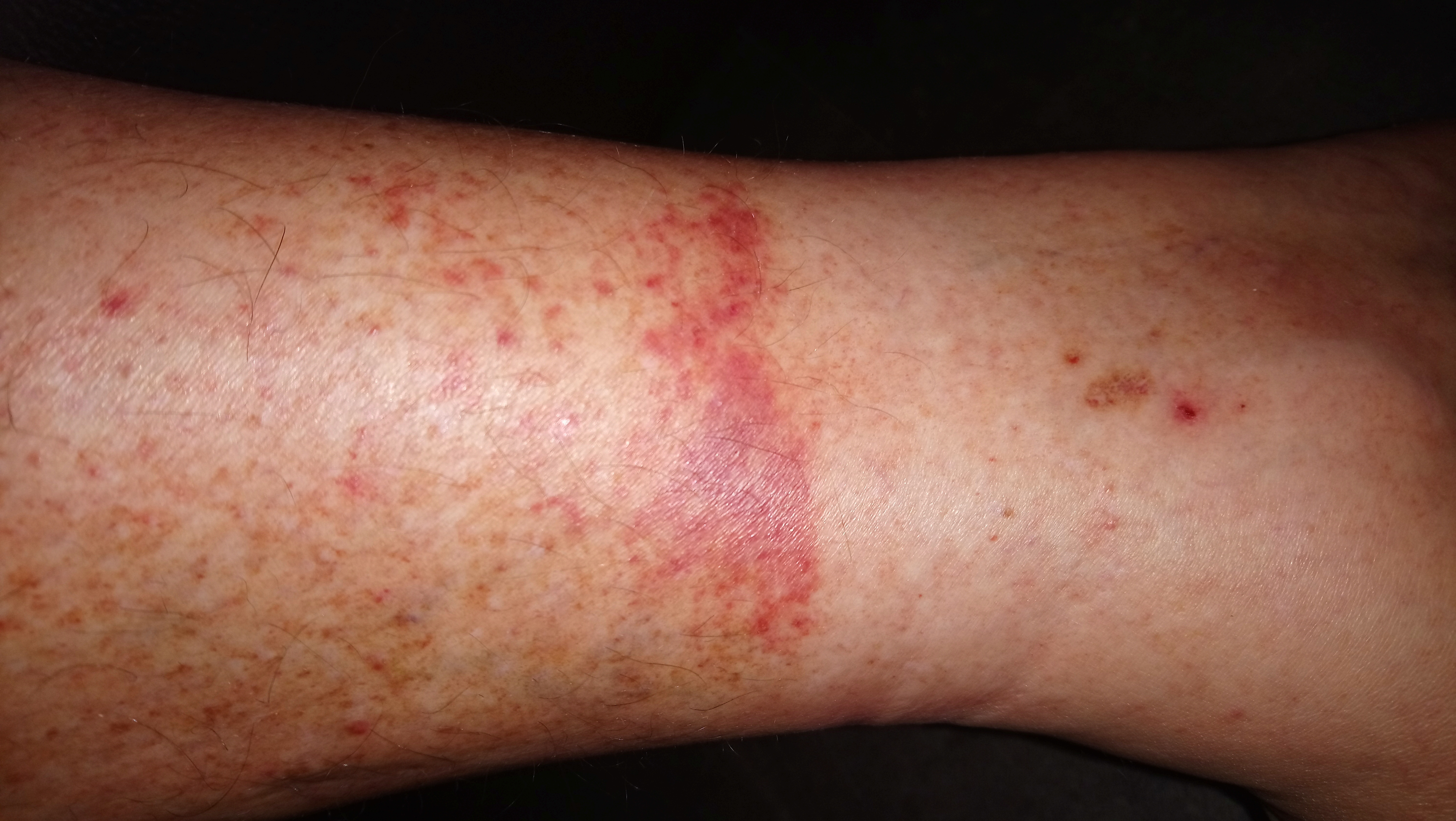 Picture for question