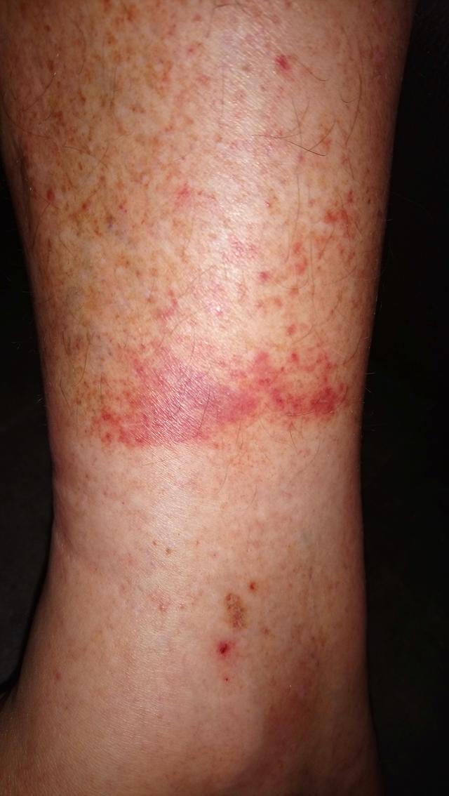 Picture for question