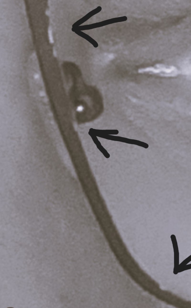 Picture for question