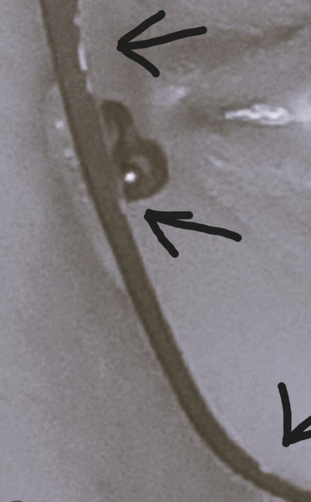 Picture for question