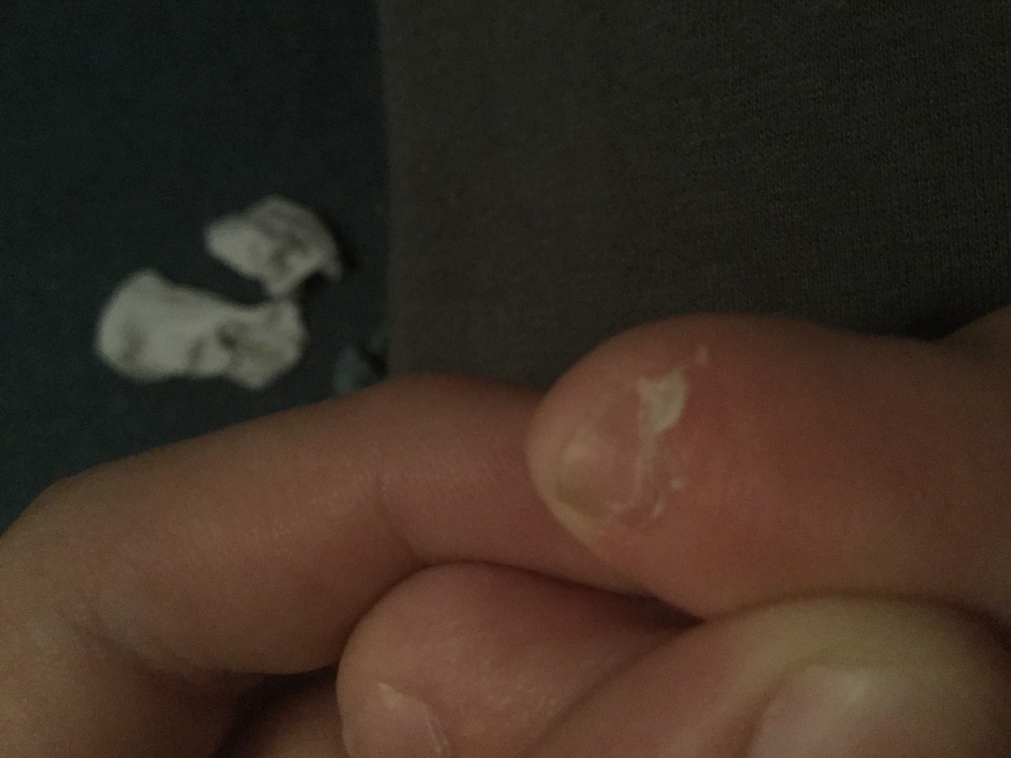 Picture for question