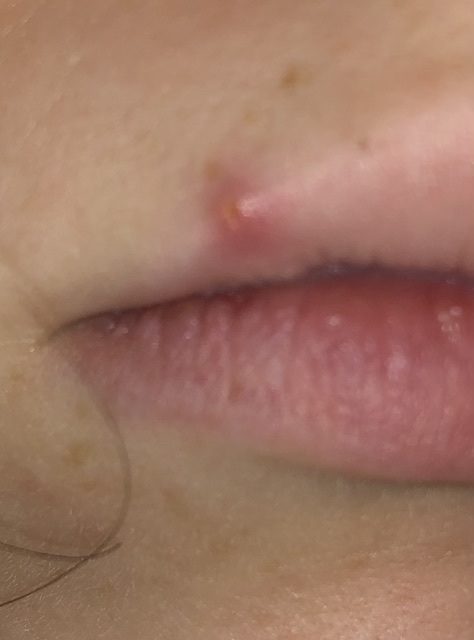 Picture for question