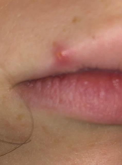 Picture for question