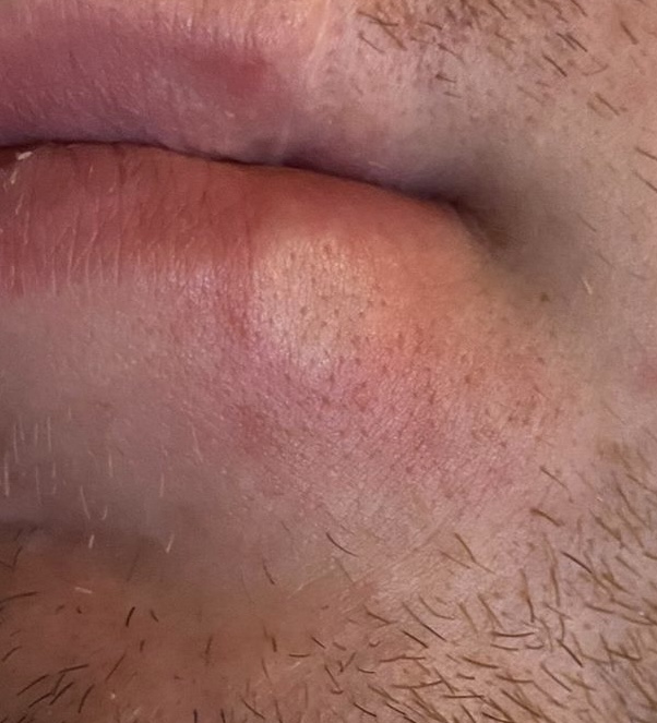 Picture for question