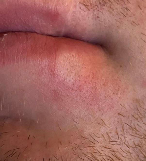 Picture for question