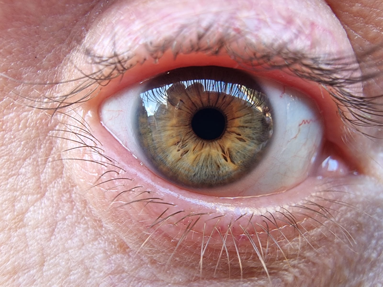 Picture for question