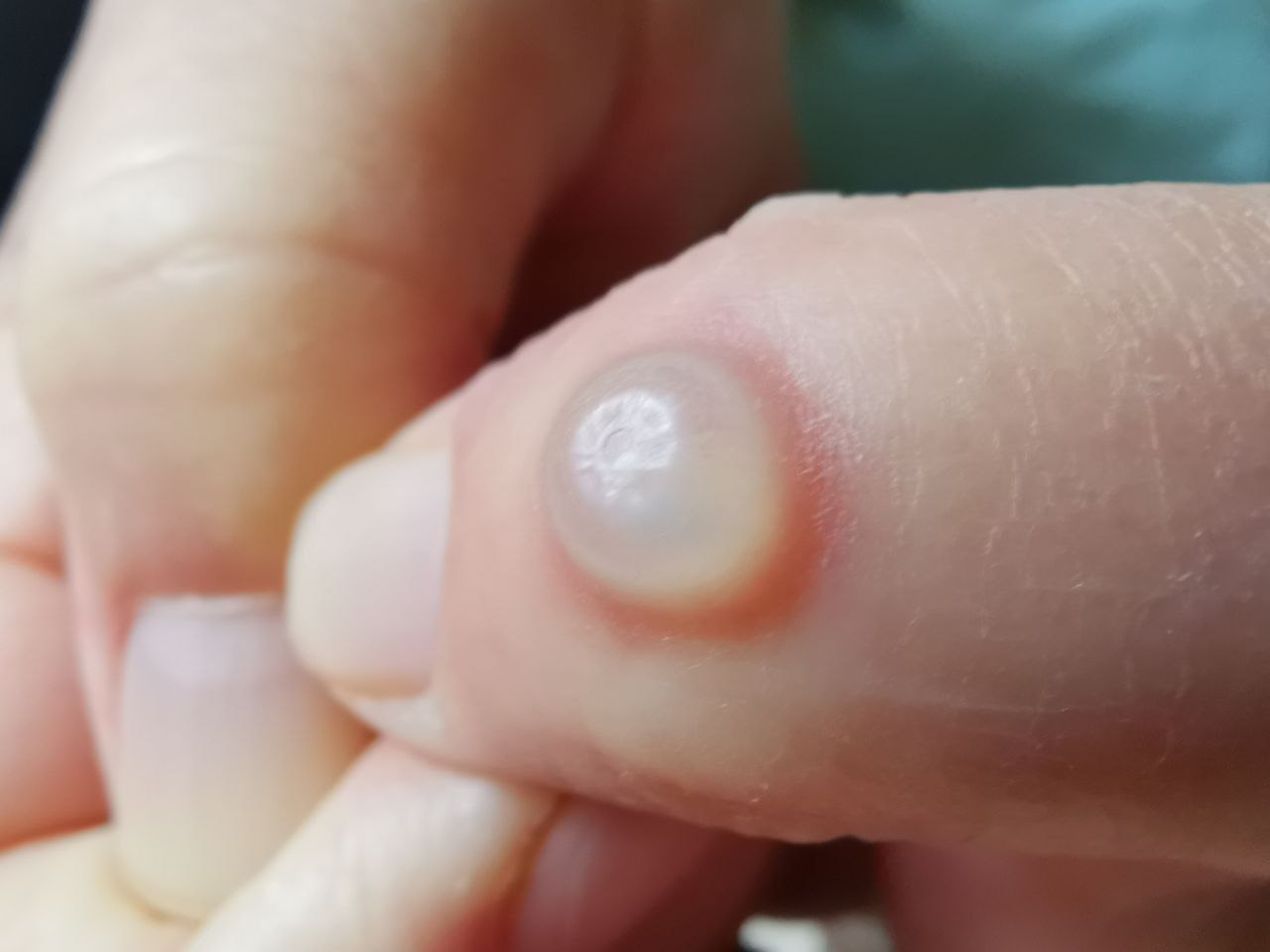 Picture for question