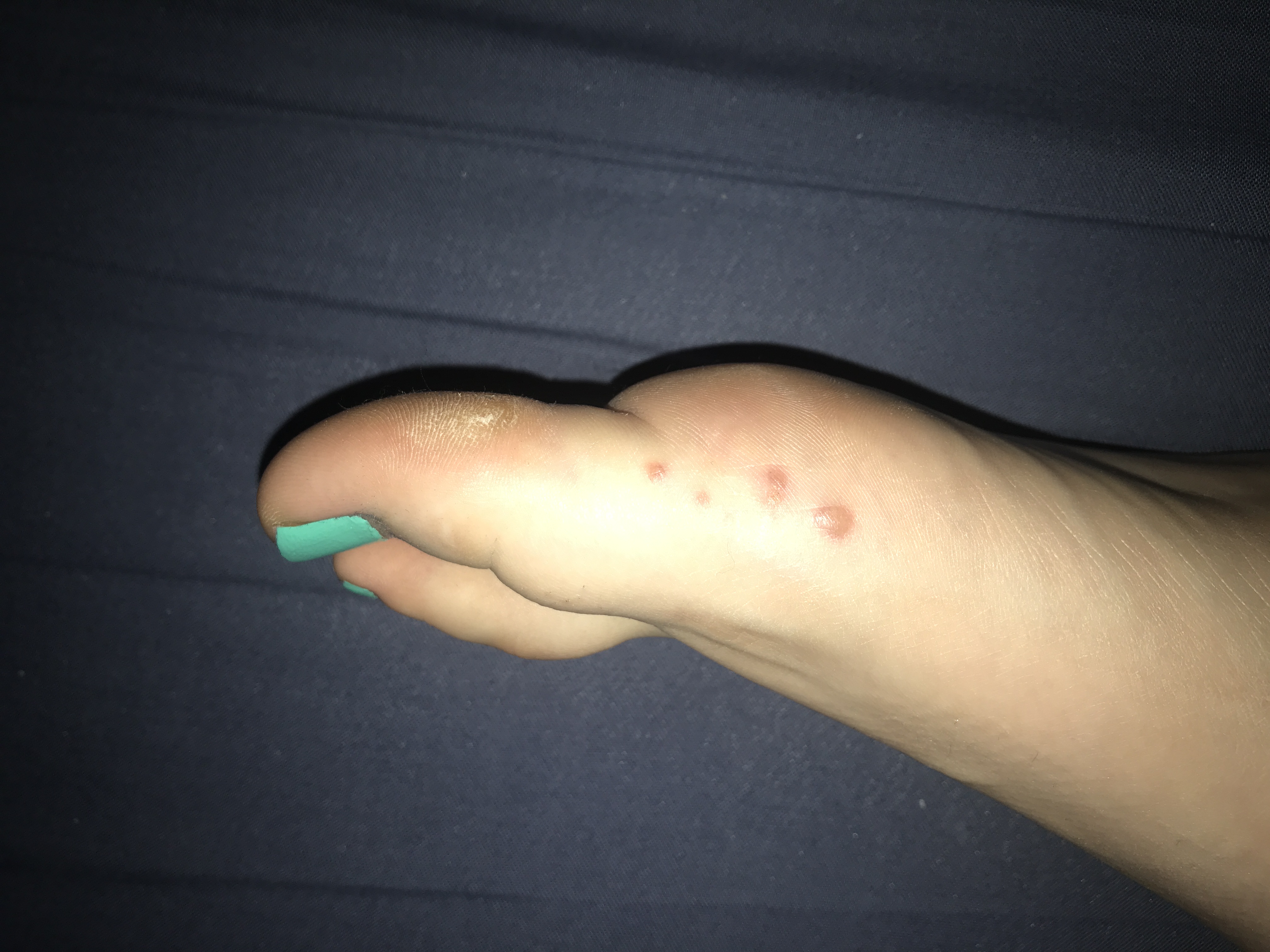 Picture for question