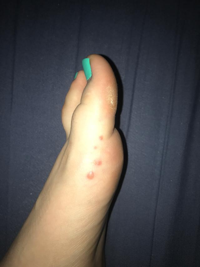 Picture for question